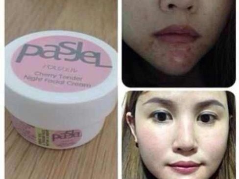 跟痘痘说拜拜，这些好牌子让你脸面光鲜